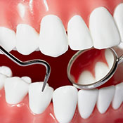 Periodontoloji